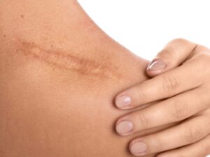 Réaliser une prestation de pigmentation réparatrice à Nice éligible CPF RS 6716